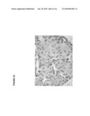 Modulators of SC4MOL for treating acne or hyperseborrhea diagram and image