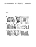 NoGo Receptor 1 and Fibroblast Growth Factor Interactions diagram and image