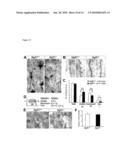 NoGo Receptor 1 and Fibroblast Growth Factor Interactions diagram and image