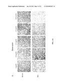 IDENTIFICATION OF ANTI-CANCER COMPOUNDS AND COMPOUNDS FOR TREATING HUNTINGTON S DISEASE AND METHODS OF TREATMENT THEREOF diagram and image