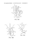 METHODS AND DEVICES FOR TISSUE GRASPING AND ASSESSMENT diagram and image