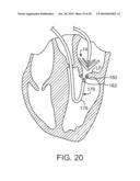 METHODS AND DEVICES FOR TISSUE GRASPING AND ASSESSMENT diagram and image