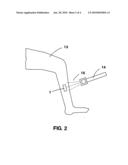 Implantable Chip Medical Diagnostic Device for Bodily Fluids diagram and image