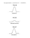 Ultrasonic Image Processor diagram and image