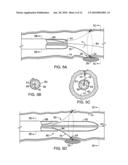 INTRALUMINAL SPECTROSCOPE WITH WALL CONTACTING PROBE diagram and image