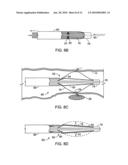 INTRALUMINAL SPECTROSCOPE WITH WALL CONTACTING PROBE diagram and image