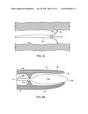 INTRALUMINAL SPECTROSCOPE WITH WALL CONTACTING PROBE diagram and image