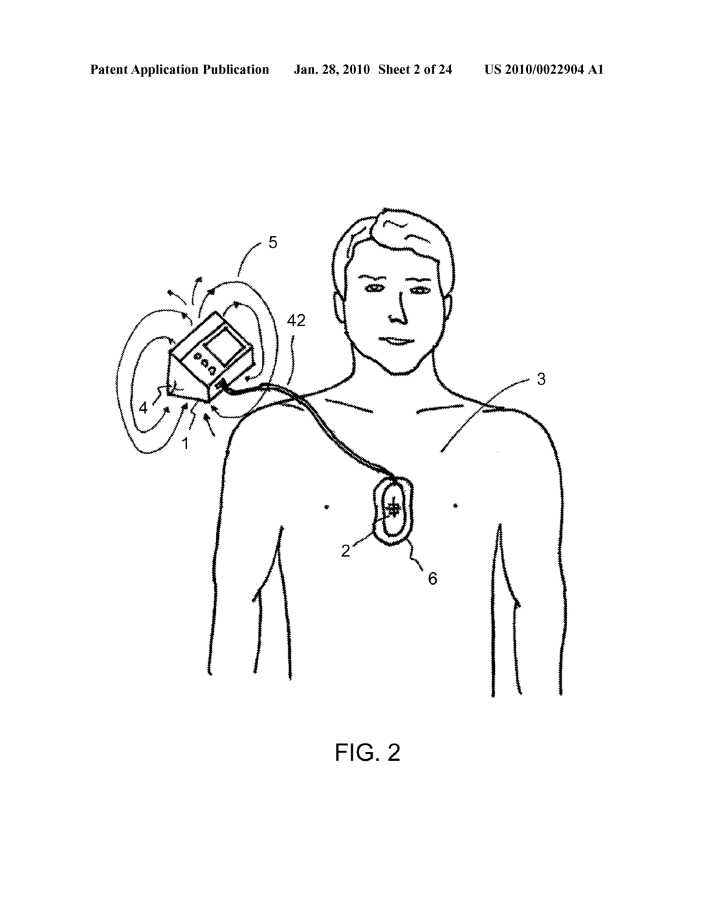 CPR ASSIST DEVICE FOR MEASURING COMPRESSION VARIABLES DURING CARDIOPULMONARY RESUSCITATION - diagram, schematic, and image 03