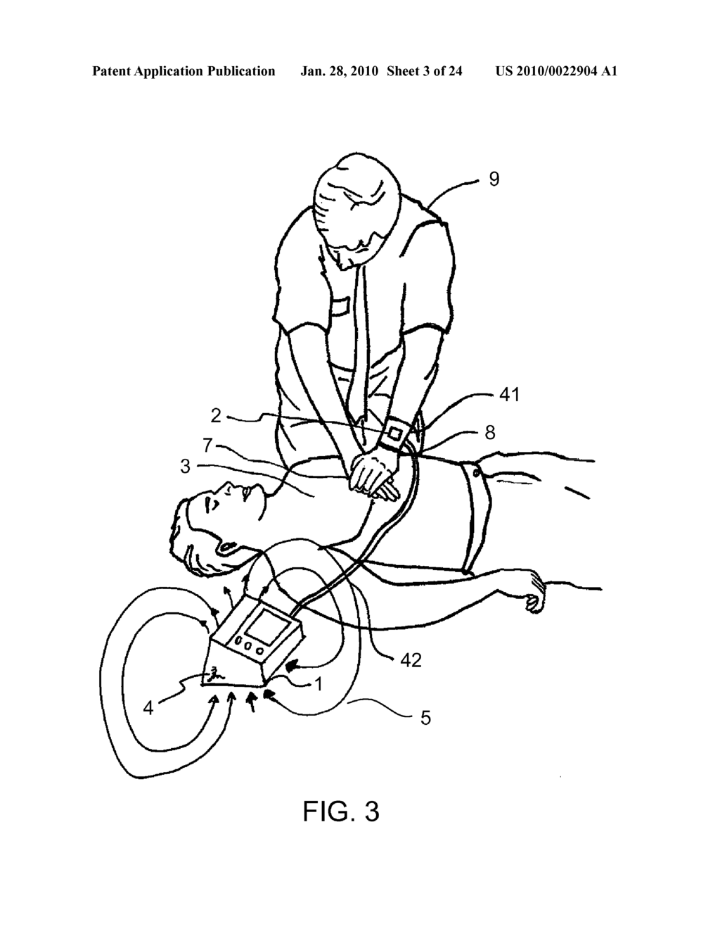 CPR ASSIST DEVICE FOR MEASURING COMPRESSION VARIABLES DURING CARDIOPULMONARY RESUSCITATION - diagram, schematic, and image 04