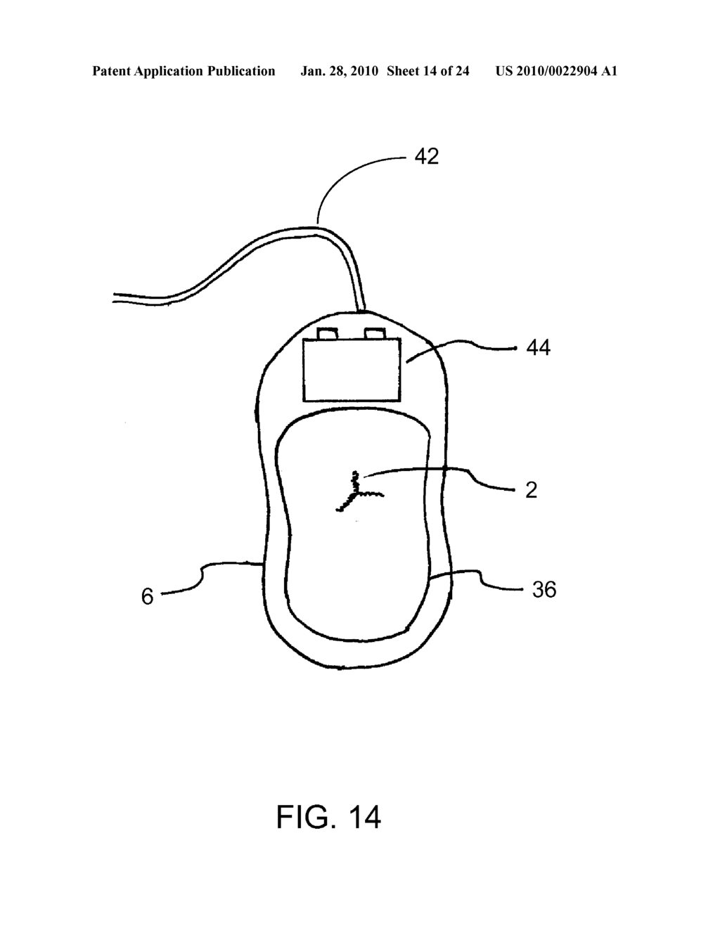 CPR ASSIST DEVICE FOR MEASURING COMPRESSION VARIABLES DURING CARDIOPULMONARY RESUSCITATION - diagram, schematic, and image 15