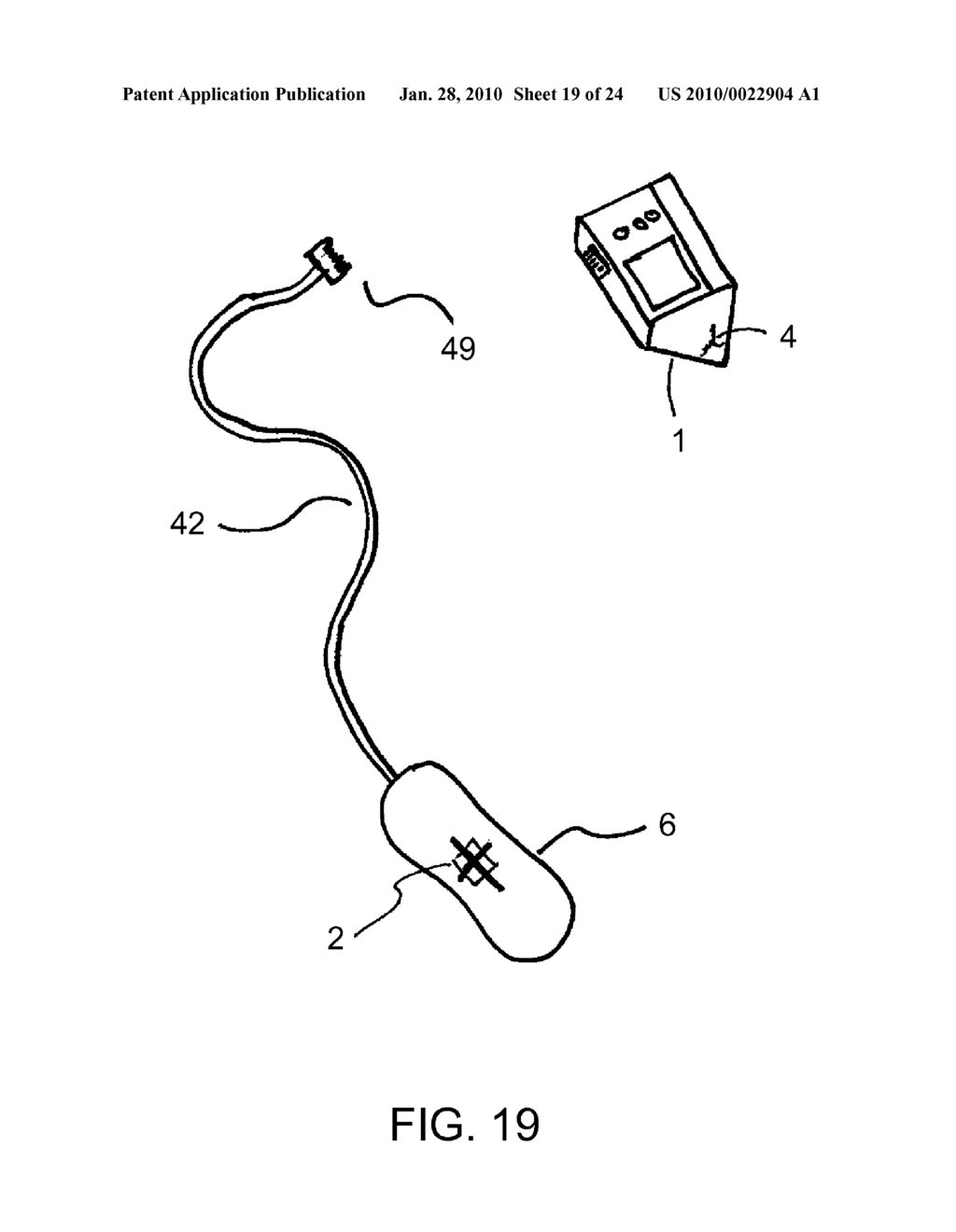 CPR ASSIST DEVICE FOR MEASURING COMPRESSION VARIABLES DURING CARDIOPULMONARY RESUSCITATION - diagram, schematic, and image 20