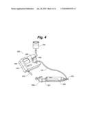 Methods of Skin Grafting Using Ultrasound diagram and image