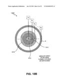 METHOD AND SYSTEM FOR TREATING STRETCH MARKS diagram and image