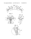 Cannula tip for use with a vad diagram and image