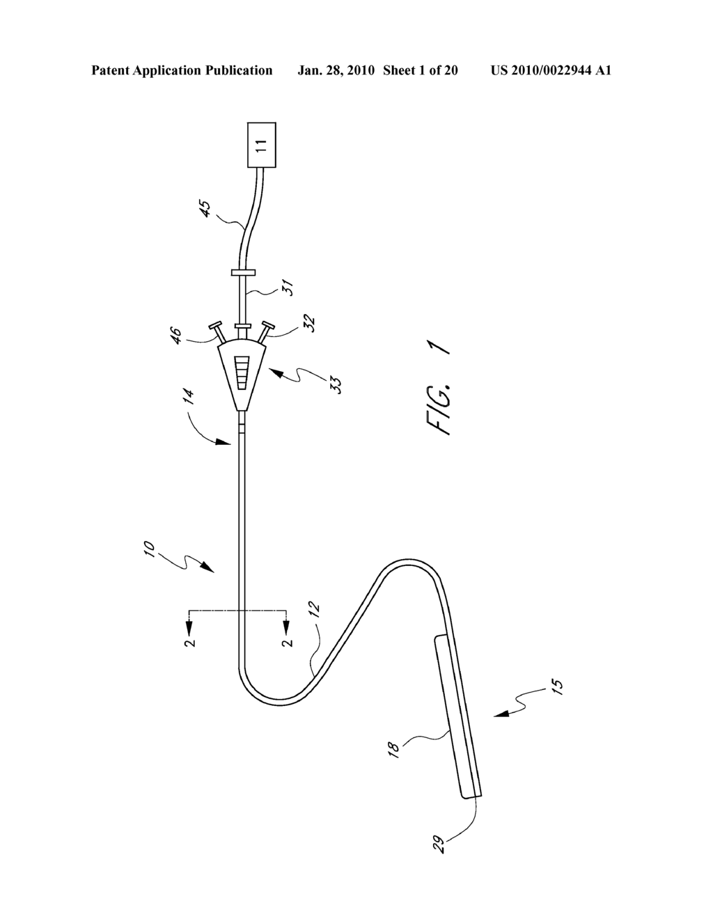 METHOD AND APPARATUS FOR TREATING AN ACUTE MYOCARDIAL INFARCTION - diagram, schematic, and image 02