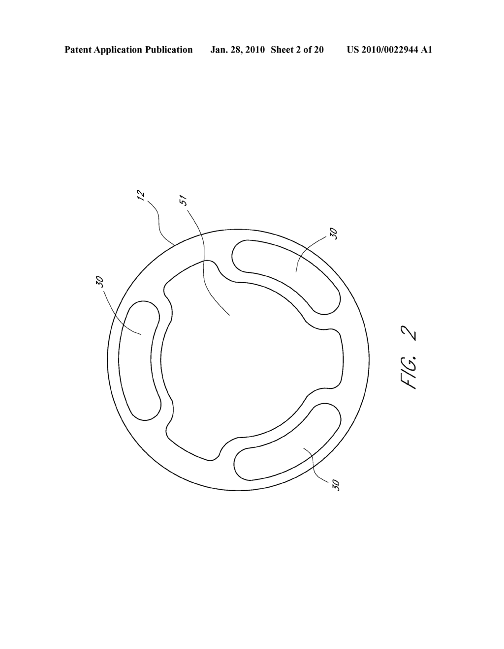 METHOD AND APPARATUS FOR TREATING AN ACUTE MYOCARDIAL INFARCTION - diagram, schematic, and image 03