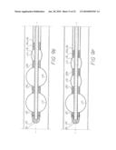 INFLATABLE CHAMBER DEVICE FOR MOTION THROUGH A PASSAGE diagram and image