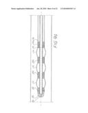 INFLATABLE CHAMBER DEVICE FOR MOTION THROUGH A PASSAGE diagram and image