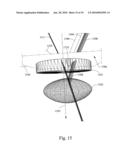 METHOD AND SYSTEM FOR REMOVAL AND REPLACEMENT OF LENS MATERIAL FROM THE LENS OF AN EYE diagram and image