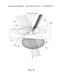 METHOD AND SYSTEM FOR REMOVAL AND REPLACEMENT OF LENS MATERIAL FROM THE LENS OF AN EYE diagram and image