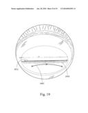 METHOD AND SYSTEM FOR REMOVAL AND REPLACEMENT OF LENS MATERIAL FROM THE LENS OF AN EYE diagram and image