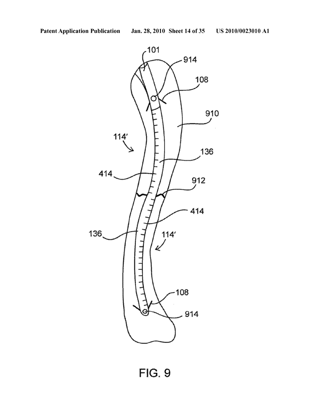 FRACTURE FIXATION DEVICE, TOOLS AND METHODS - diagram, schematic, and image 15