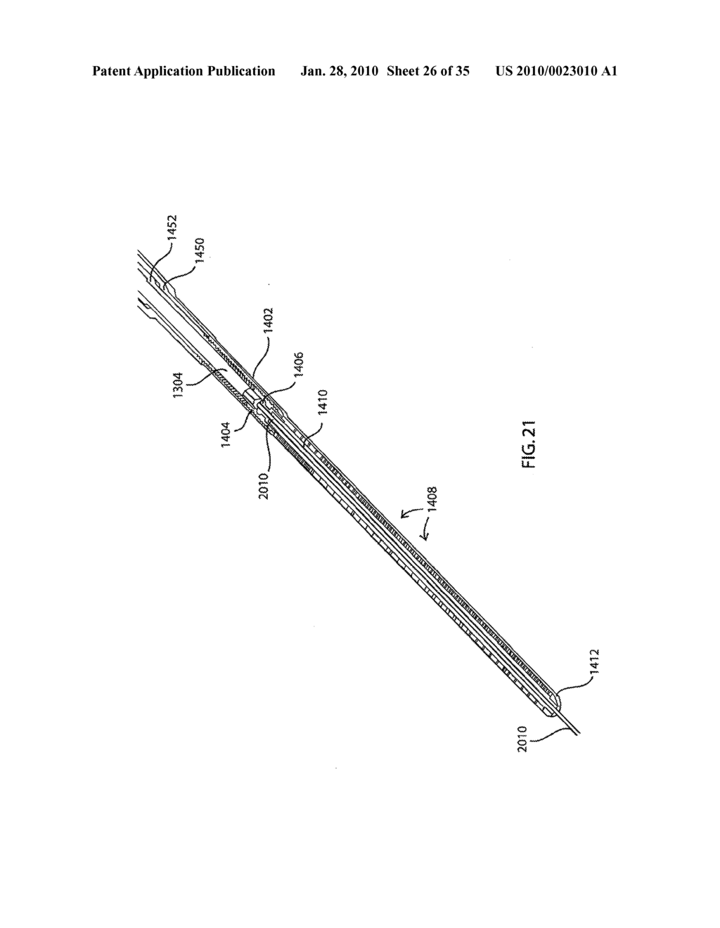 FRACTURE FIXATION DEVICE, TOOLS AND METHODS - diagram, schematic, and image 27