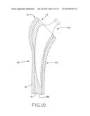 GENDER SPECIFIC FEMORAL RASPS diagram and image