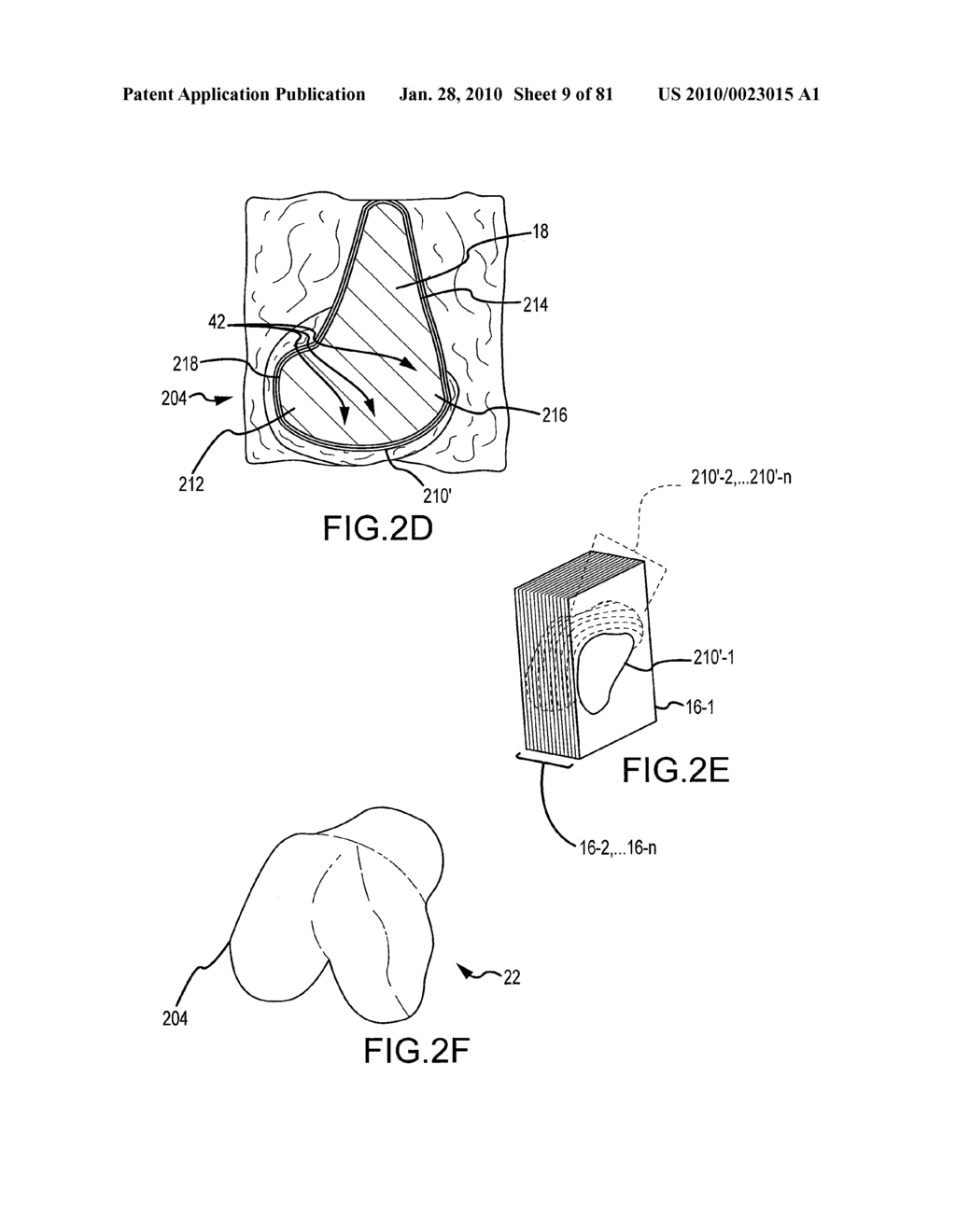 SYSTEM AND METHOD FOR MANUFACTURING ARTHROPLASTY JIGS HAVING IMPROVED MATING ACCURACY - diagram, schematic, and image 10