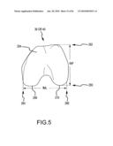 SYSTEM AND METHOD FOR MANUFACTURING ARTHROPLASTY JIGS HAVING IMPROVED MATING ACCURACY diagram and image