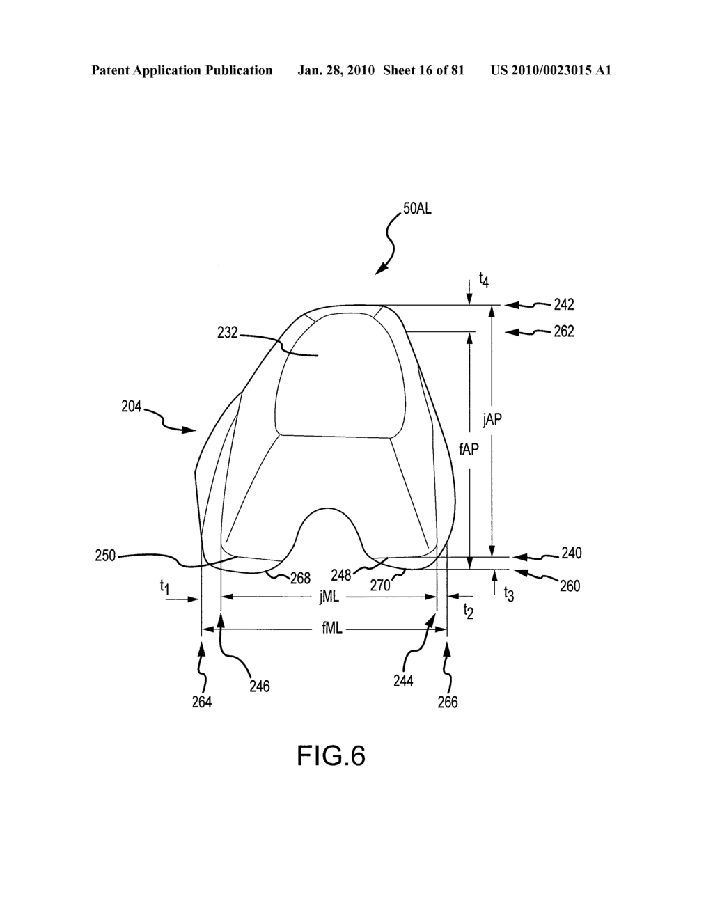 SYSTEM AND METHOD FOR MANUFACTURING ARTHROPLASTY JIGS HAVING IMPROVED MATING ACCURACY - diagram, schematic, and image 17