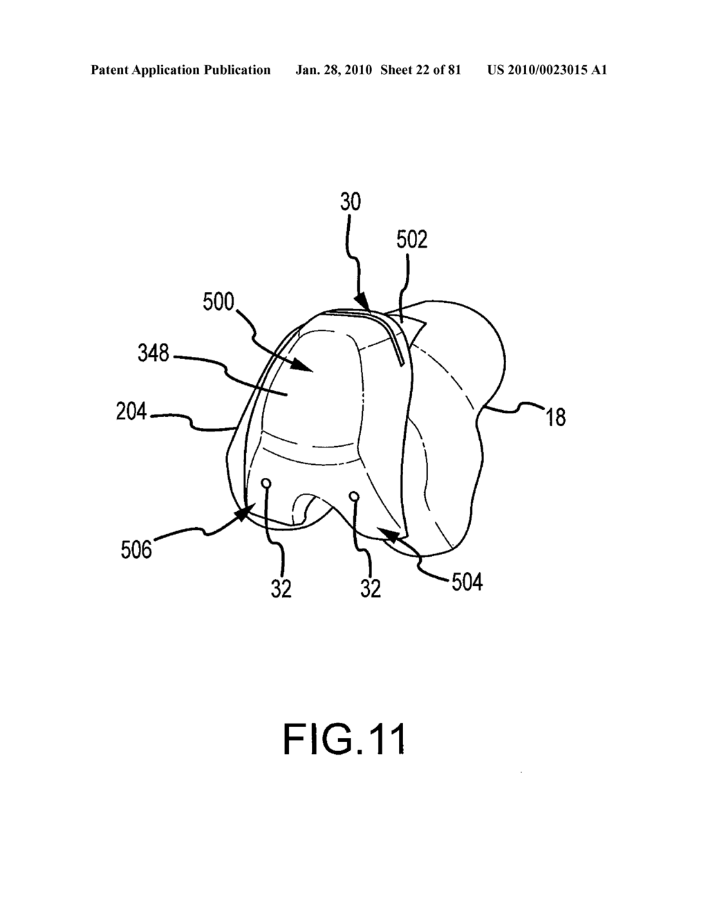 SYSTEM AND METHOD FOR MANUFACTURING ARTHROPLASTY JIGS HAVING IMPROVED MATING ACCURACY - diagram, schematic, and image 23