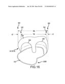 SYSTEM AND METHOD FOR MANUFACTURING ARTHROPLASTY JIGS HAVING IMPROVED MATING ACCURACY diagram and image