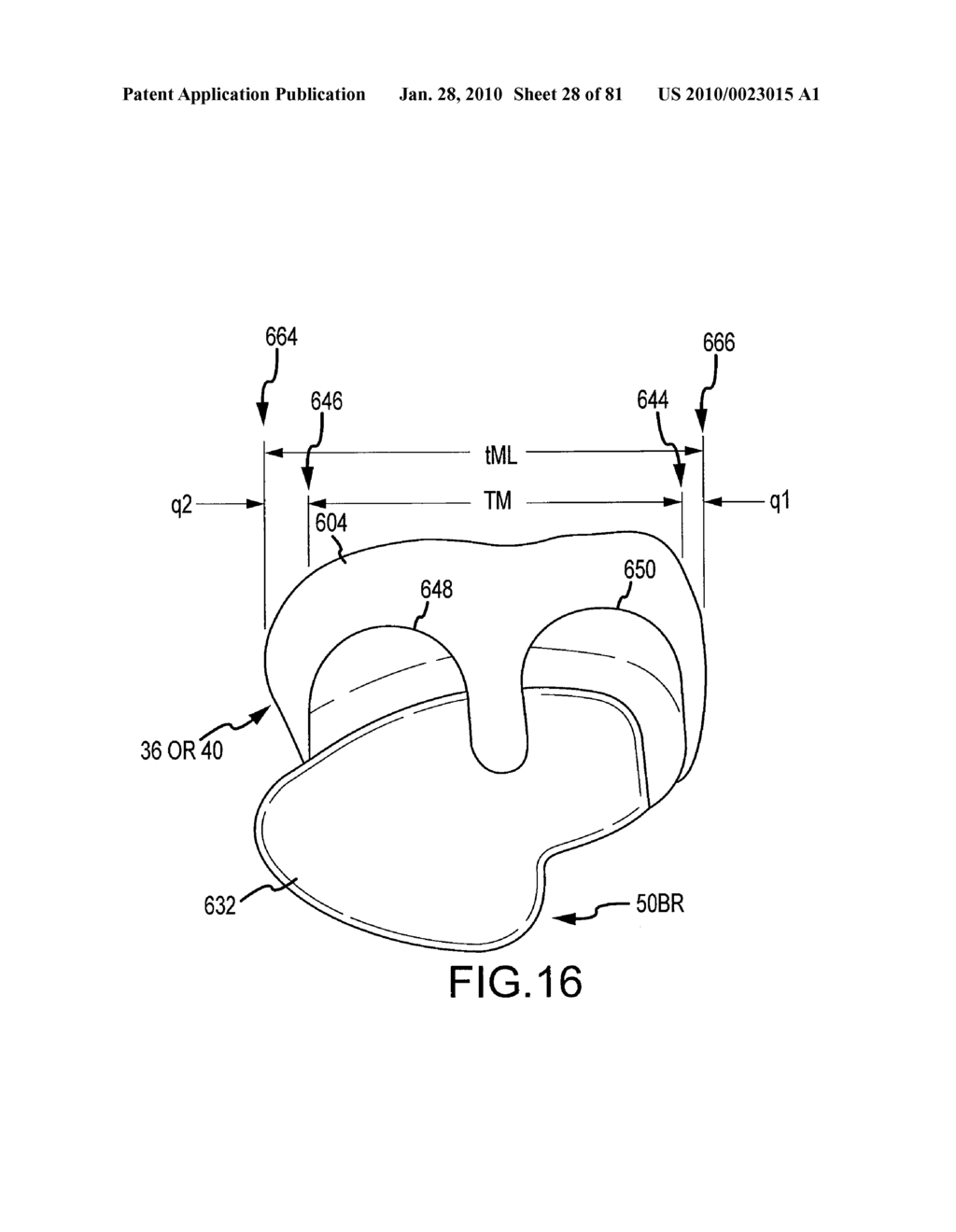 SYSTEM AND METHOD FOR MANUFACTURING ARTHROPLASTY JIGS HAVING IMPROVED MATING ACCURACY - diagram, schematic, and image 29