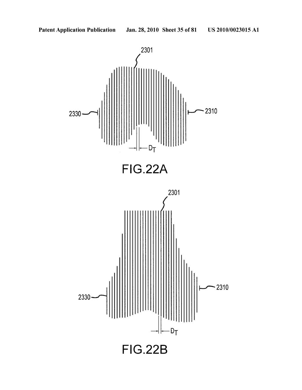 SYSTEM AND METHOD FOR MANUFACTURING ARTHROPLASTY JIGS HAVING IMPROVED MATING ACCURACY - diagram, schematic, and image 36