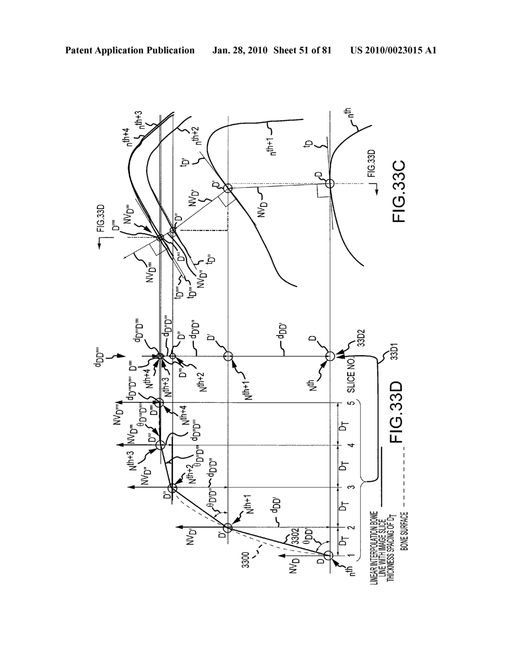 SYSTEM AND METHOD FOR MANUFACTURING ARTHROPLASTY JIGS HAVING IMPROVED MATING ACCURACY - diagram, schematic, and image 52