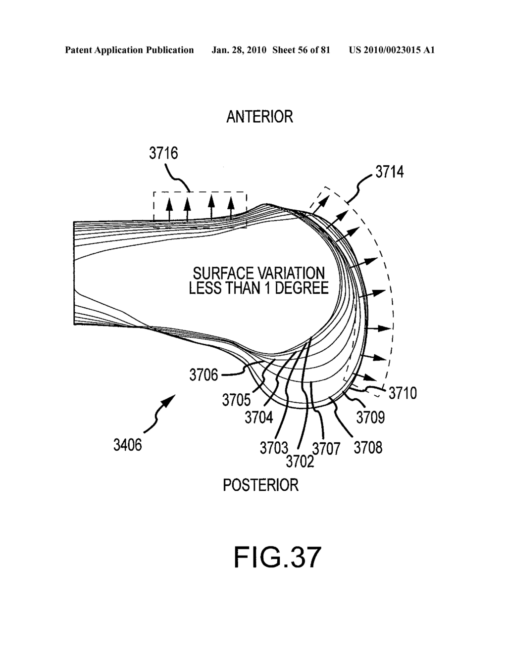 SYSTEM AND METHOD FOR MANUFACTURING ARTHROPLASTY JIGS HAVING IMPROVED MATING ACCURACY - diagram, schematic, and image 57