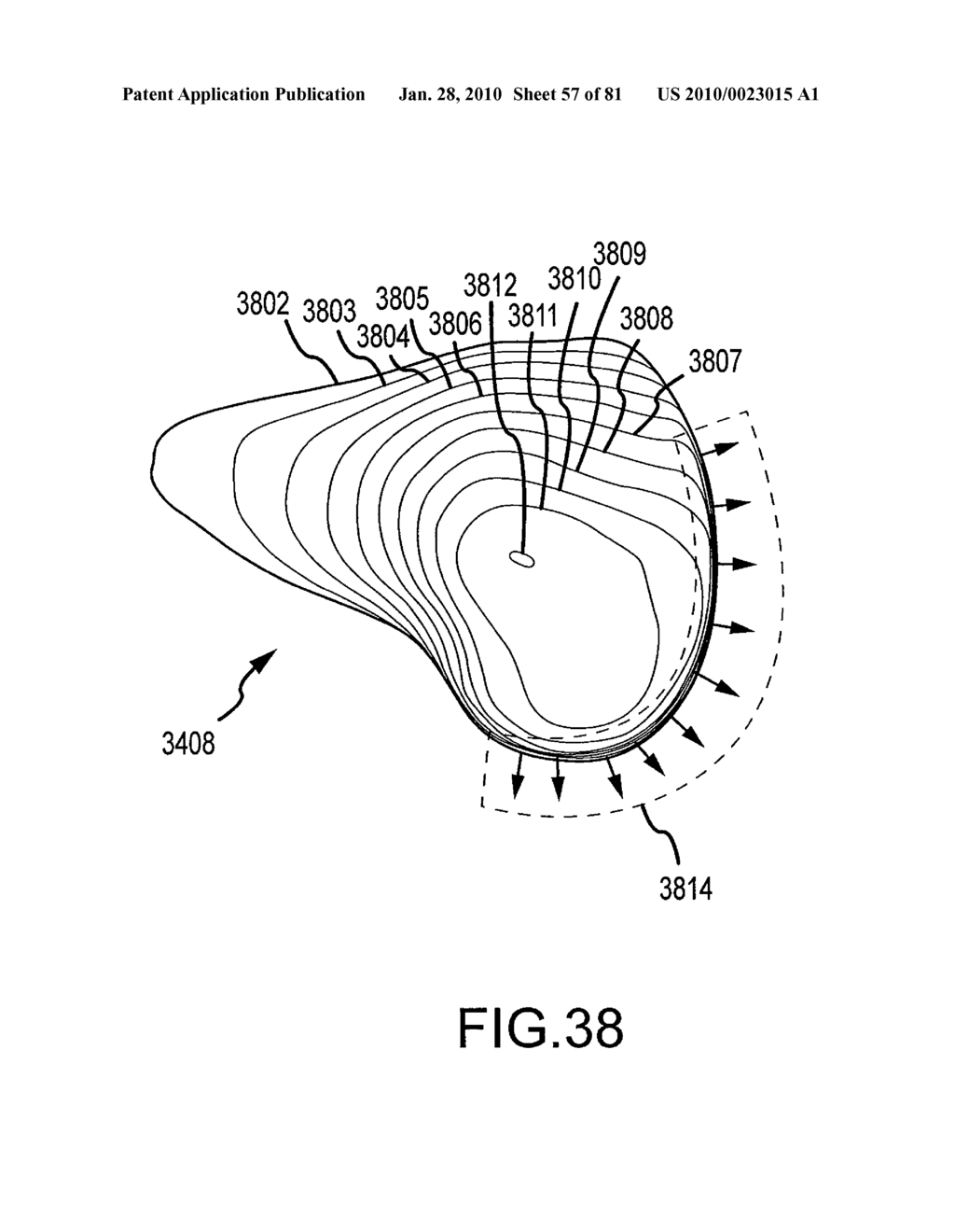 SYSTEM AND METHOD FOR MANUFACTURING ARTHROPLASTY JIGS HAVING IMPROVED MATING ACCURACY - diagram, schematic, and image 58