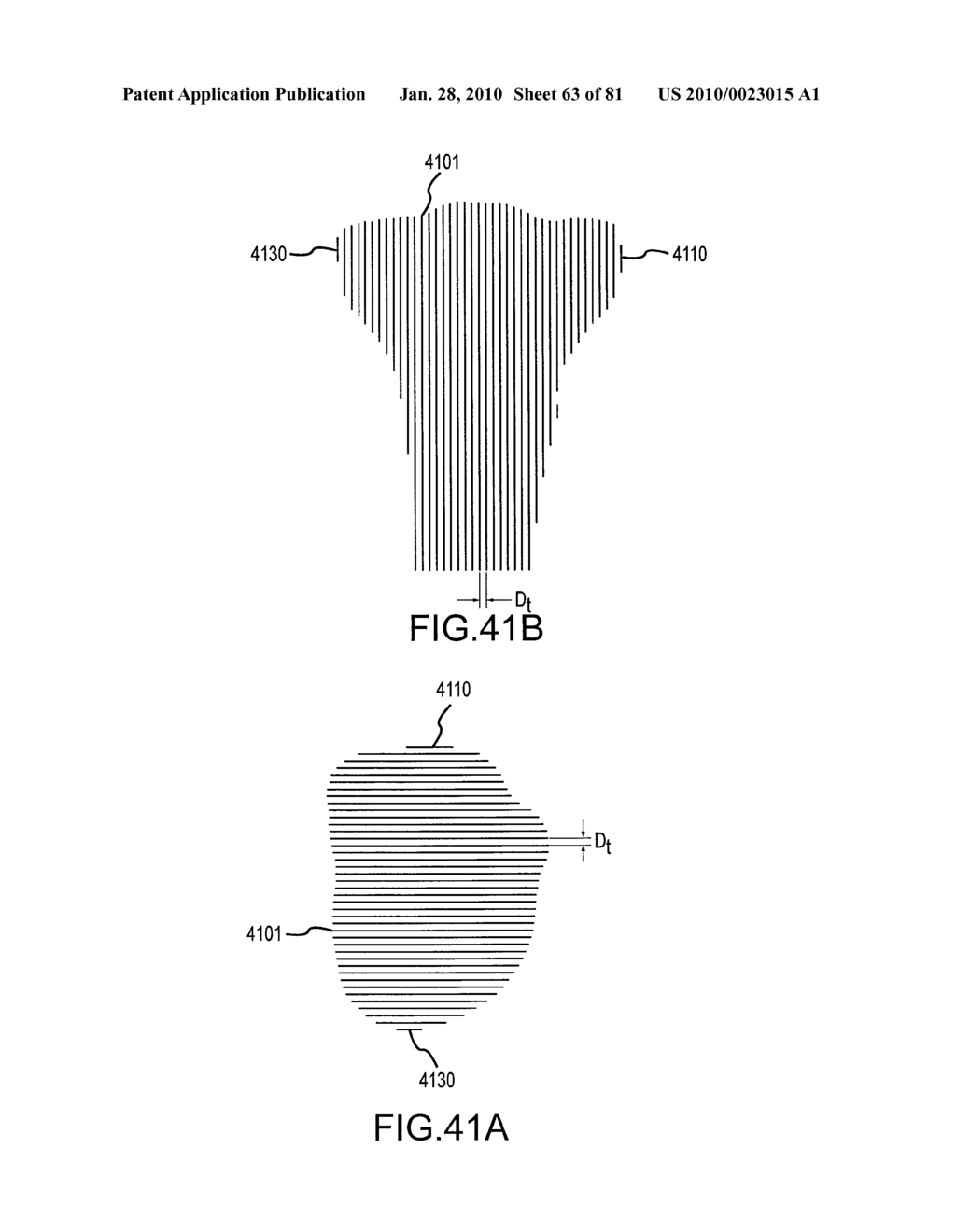 SYSTEM AND METHOD FOR MANUFACTURING ARTHROPLASTY JIGS HAVING IMPROVED MATING ACCURACY - diagram, schematic, and image 64