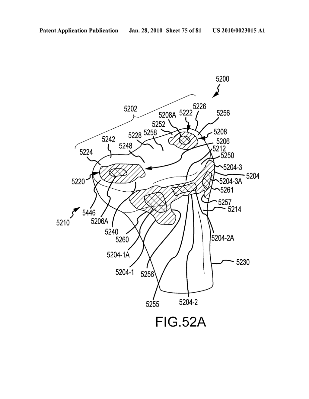 SYSTEM AND METHOD FOR MANUFACTURING ARTHROPLASTY JIGS HAVING IMPROVED MATING ACCURACY - diagram, schematic, and image 76