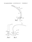 TOOLS AND METHODS FOR ORTHOPEDIC SURGERY diagram and image