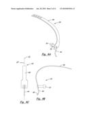 TOOLS AND METHODS FOR ORTHOPEDIC SURGERY diagram and image