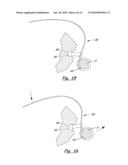 TOOLS AND METHODS FOR ORTHOPEDIC SURGERY diagram and image