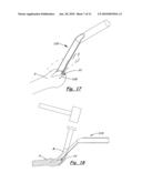 TOOLS AND METHODS FOR ORTHOPEDIC SURGERY diagram and image