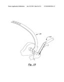 TOOLS AND METHODS FOR ORTHOPEDIC SURGERY diagram and image