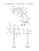 TOOLS AND METHODS FOR ORTHOPEDIC SURGERY diagram and image