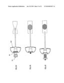 INSTRUMENTATION KIT FOR DELIVERING VISCOUS BONE FILLER MATERIAL diagram and image