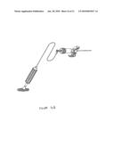 INSTRUMENTATION KIT FOR DELIVERING VISCOUS BONE FILLER MATERIAL diagram and image