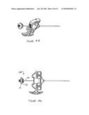 INSTRUMENTATION KIT FOR DELIVERING VISCOUS BONE FILLER MATERIAL diagram and image