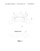 PROSTHESIS FOR ANASTOMOSIS diagram and image